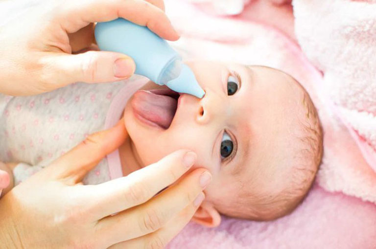 Xử trí tại nhà khi trẻ bị sổ mũi
